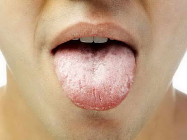 how your tongue tells you about your health